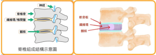 1074的圖_椎間盤